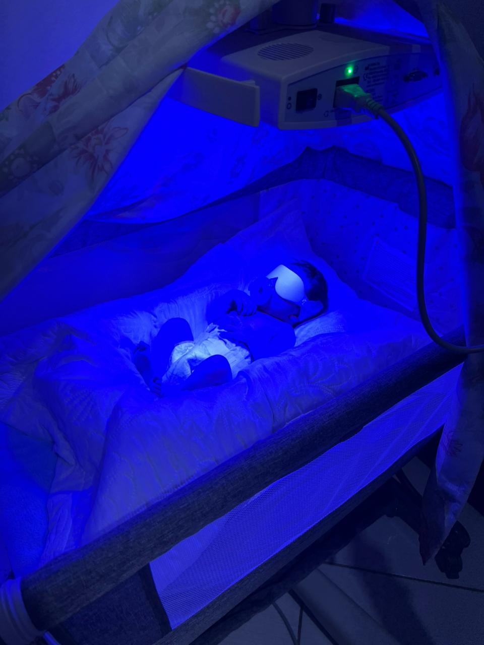 Bebê fazendo fototerapia neonatal em casa